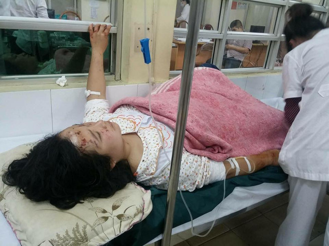 Nạn nhân vụ nổ Văn Phú kể lại phút kinh hoàng, kính văng khắp người ảnh 1