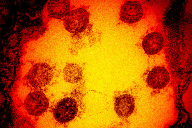 Ảnh chỉ có tính minh họa. (Nguồn: Wired) Nghiên cứu mới về thời gian virus SARS-CoV-2 tồn tại trên da người ảnh 1