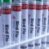 Hình ảnh minh hoạ ống xét nghiệm đựng mẫu bệnh phẩm virus cúm gia cầm. (Ảnh: Reuters/TTXVN)