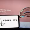 Công ty Neuralink của Elon Musk đã lần đầu tiên tiến hành thử nghiệm cấy chip vào não người. (Nguồn: Shutterstock)