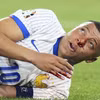 Mbappe dính chấn thương mũi trong trận Pháp thắng Áo 1-0. (Nguồn: X)