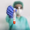(Nguồn: Africa CDC)