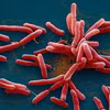 Hình ảnh vi khuẩn Burkholderia pseudomallei gây bệnh Whitmore. (Nguồn: Bộ Y tế)