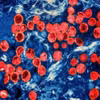 Hình ảnh virus đậu mùa khỉ dưới kính hiển vi. (Ảnh: Getty Images/TTXVN)
