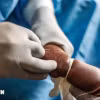 Nhân viên y tế điều trị cho em nhỏ mắc đậu mùa khỉ tại Nyiragongo, Cộng hòa Dân chủ Congo ngày 15/8/2024. (Ảnh: THX/TTXVN)