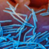 Virus hợp bào hô hấp RSV (màu xanh) và kháng thể RSV (màu vàng). (Ảnh: AP/TTXVN)