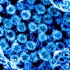 Virus SARS-CoV-2 trong mẫu bệnh phẩm của bệnh nhân mắc COVID-19. (Ảnh: AFP/TTXVN)