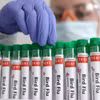 Bệnh nhân nam 59 tuổi, người Mexico, nhiễm virus cúm gia cầm H5N2 và đã qua đời ngày 24/4. (Ảnh minh họa. Nguồn: Reuters)