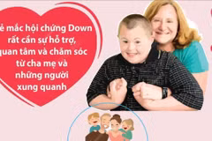 Ngày Hội chứng Down thế giới 21/3: Giúp trẻ mắc bệnh hòa nhập cộng đồng