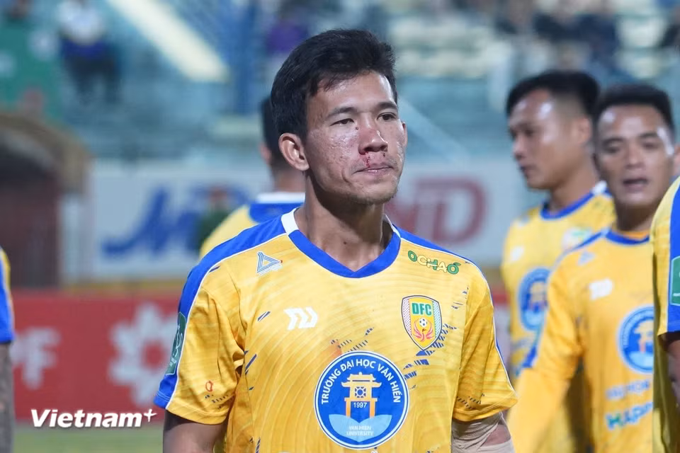 Máu đã đổ trên khuôn mặt của hậu vệ Ngọc Thịnh bên phía Đồng Tháp, tuy nhiên cầu thủ mang áo số 23 vẫn kiên cường thi đấu đến hết trận. (Ảnh: Việt Anh/Vietnam+)