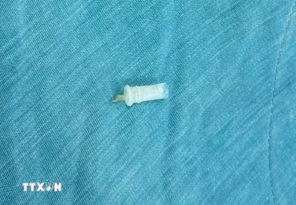 Đồng Nai: Cấp cứu thành công bé trai 11 tuổi bị hóc kèn đồ chơi