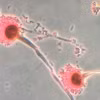 Nấm Aspergillus. (Nguồn: CNN)