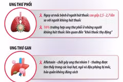 Điểm tên 5 “sát thủ ung thư” nguy hiểm nhất
