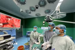 Ca phẫu thuật nội soi cắt bỏ hoàn toàn khối u vỏ bao thần kinh hiếm cho bệnh nhân. (Ảnh: TTXVN phát)