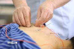 Các bệnh nhân được sử dụng phương pháp Điện châm tại Bệnh viện Y học cổ truyền tỉnh Lạng Sơn. (Ảnh: Anh Tuấn/TTXVN)