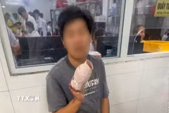 Anh Lâm Thanh Nhân bị tai nạn lao động đứt 4 ngón tay phải được Tổ công tác Trạm Cảnh sát giao thông Mỹ Xuyên hỗ trợ dẫn đường đến cấp cứu tại Bệnh viện Đa khoa Trung ương Cần Thơ. (Ảnh: TTXVN phát)