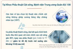 Việt Nam lần đầu phẫu thuật thành công nắn chỉnh vẹo cột sống không ghép xương