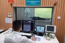 Hệ thống chụp cộng hưởng từ 3.0 Tesla uMR 780 tích hợp trí tuệ nhân tạo với nền tảng AI hỗ trợ tái tạo hình ảnh, nâng cao độ phân giải và rút ngắn thời gian chụp cho bệnh nhân. (Ảnh: Việt Hoàng/TTXVN)