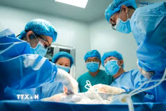 Các bác sỹ Bệnh viện Quân đội 108 (Hà Nội) và Bệnh viện Thống Nhất Thành phố Hồ Chí Minh ghép gan cho người bệnh. (Ảnh: TTXVN phát)