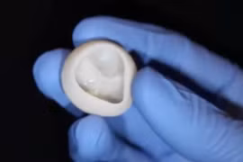 Một van tim chức năng không có collagen được tạo ra bằng máy in 3D. (Ảnh: AFP)