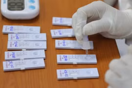 Mẫu phẩm xét nghiệm COVID-19 của công nhân viên Bến xe Giáp Bát, sáng 15/3. (Ảnh: Hoàng Hiếu/TTXVN)