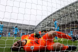 Hugo Lloris gặp chấn thương ở khuỷu tay và phải rời sân bằng cáng. (Ảnh: Fox Sport Asia)