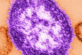 Virus bệnh sởi. (Nguồn: businessinsider.com.au)