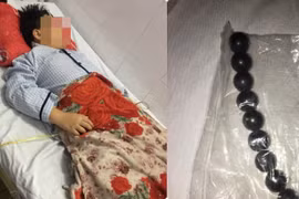 Vụ học sinh nuốt 9 viên bi: Xác minh dấu hiệu bạo lực học đường