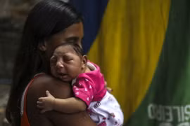 Em bé 1 tháng tuổi mắc chứng đầu nhỏ tại Rio de Janeiro của Brazil. (Ảnh: EPA/TTXVN)