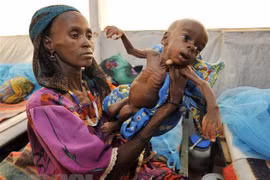 Trẻ em bị suy dinh dưỡng tại Tanout, Nam Niger. (Nguồn: AFP/TTXVN)
