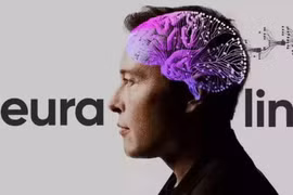 Neuralink, công ty sản xuất chip não của tỷ phú Elon Musk. (Nguồn: Neuralink)