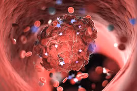 Ảnh minh họa. (Nguồn: weillcornell.org)