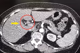 Hình ảnh chụp CT về ca bệnh. (Ảnh: Chanh Đa/TTXVN)