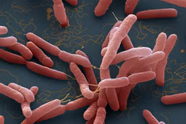 Vi khuẩn Burkholderia pseudomallei. (Nguồn: NPR)