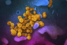 Hình ảnh do Viện nghiên cứu y tế quốc gia cung cấp cho thấy hình ảnh virus SARS-CoV-2 (màu vàng) gây dịch viêm đường hô hấp cấp COVID-19 nổi lên trên bề mặt tế bào (màu xanh, hồng) của một bệnh nhân COVID-19 ở Mỹ. (Ảnh: AFP/TTXVN)