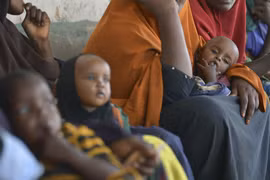 Trẻ em suy dinh dưỡng được điều trị tại Baidoa, Somalia. (Nguồn: AFP/TTXVN)