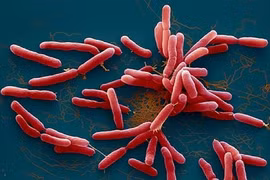 Hình ảnh vi khuẩn Burkholderia pseudomallei gây bệnh Whitmore. (Nguồn: Bộ Y tế)
