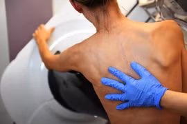 Phát hiện mới mở ra triển vọng trong điều trị bệnh ung thư vú