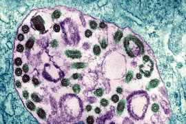 Guinea Xích đạo ghi nhận các ca tử vong do nhiễm virus Marburg