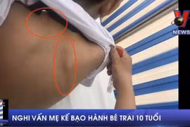 [Video] Làm rõ nghi vấn mẹ kế bạo hành bé trai 10 tuổi
