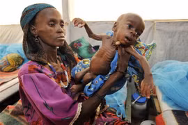 Trẻ em bị suy dinh dưỡng tại Tanout, Nam Niger. (Nguồn: AFP/TTXVN) 