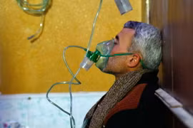 Người dân Syria được điều trị triệu chứng khó thở sau một vụ tấn công được cho là sử dụng vũ khí hóa học ở Douma (Syria) ngày 22/1. (Nguồn: AFP/TTXVN)