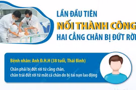 Ca bệnh đầu tiên ở Việt Nam được nối lại hai cẳng chân bị đứt rời