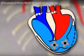 [Videographics] Những điều kỳ thú quanh trái tim nhân tạo