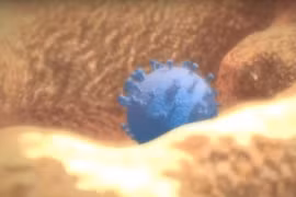 [Videographics] Virus HIV tấn công cơ thể người ra sao? 