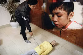 Yêu cầu xử lý nghiêm vụ cháu bé bị bố đẻ và mẹ kế bạo hành