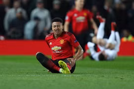 Lingard dính chấn thương. (Nguồn: Getty Images)