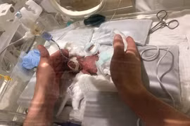 Cậu bé được cho là đang giữ kỷ lục cậu bé sơ sinh nhỏ nhất được xuất viện trong tình trạng sức khỏe tốt. (Nguồn: AFP)