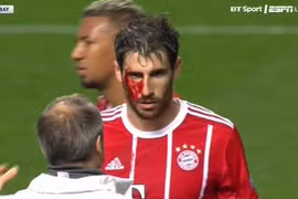 Martinez đổ máu mang chiến thắng về cho Bayern. (Nguồn: BT Sport)