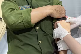 Thượng úy Hoàng Văn Dương bị thương ở cánh tay trái. (Ảnh công an cung cấp)